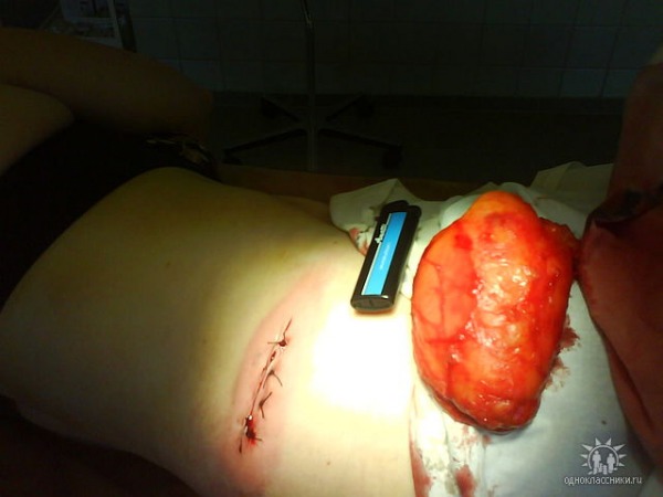 Ложкин, т.е. Хуев