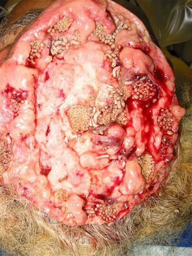 вон там вон чирвичьки,видите?